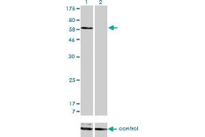 Western Blotting (WB) image for anti-Sorting Nexin 1 (SNX1) (AA 166-276) antibody (ABIN598935) (Sorting Nexin 1 Antikörper  (AA 166-276))