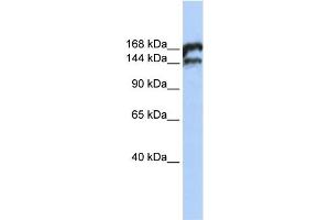 WB Suggested Anti-TOP2B Antibody Titration:  0. (TOP2B Antikörper  (Middle Region))