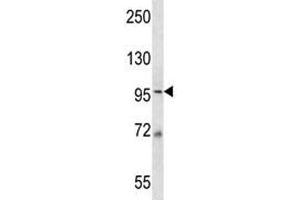 MCM6 antibody western blot analysis in 293 lysate. (MCM6 Antikörper  (AA 80-109))
