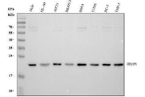 anti-TIMP Metallopeptidase Inhibitor 1 (TIMP1) (AA 24-207) antibody
