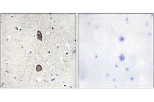 Immunohistochemistry analysis of paraffin-embedded human brain, using IGFBP-3 (Phospho-Ser183) Antibody. (IGFBP3 Antikörper  (pSer183))