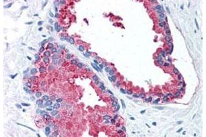 Immunohistochemistry (Formalin/PFA-fixed paraffin-embedded sections) of human prostate with LOXL2 polyclonal antibody . (LOXL2 Antikörper  (Internal Region))