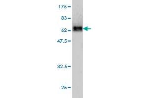 Neuroserpin Antikörper  (AA 17-410)