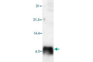 Western blot analysis of Human S100P polyclonal antibody  in HeLa cell lysate. (S100P Antikörper)
