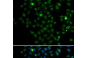 Immunofluorescence analysis of MCF-7 cells using LMO4 Polyclonal Antibody (LMO4 Antikörper)