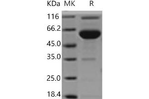 Western Blotting (WB) image for Endothelial Cell Adhesion Molecule (ESAM) protein (Fc Tag) (ABIN7321176)