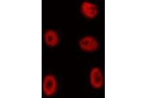 ABIN6275130 staining HepG2 by IF/ICC. (FOXD4/L2/L3/L4/L5/L6 Antikörper)