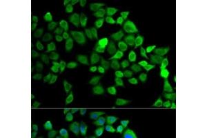 Immunofluorescence analysis of MCF-7 cells using CUL2 Polyclonal Antibody (Cullin 2 Antikörper)