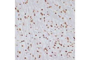 Immunohistochemistry of paraffin-embedded mouse brain using Phospho-Chk1-S280 antibody (ABIN3019445, ABIN3019446, ABIN3019447 and ABIN6225372) at dilution of 1:100 (40x lens). (CHEK1 Antikörper  (pSer280))