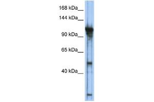 WB Suggested Anti-GTF3C2 Antibody Titration:  0. (GTF3C2 Antikörper  (Middle Region))