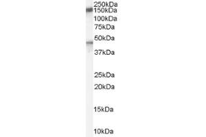 Image no. 1 for anti-Patched 1 (PTCH1) (Internal Region) antibody (ABIN374710) (Patched 1 Antikörper  (Internal Region))