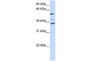 Western Blotting (WB) image for anti-Solute Carrier Family 25 (Mitochondrial Carrier, Graves Disease Autoantigen), Member 16 (SLC25A16) antibody (ABIN2458815)