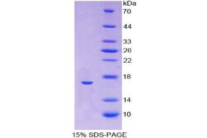 SDS-PAGE analysis of Human ANGPTL1 Protein.