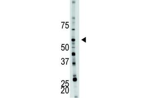Western Blotting (WB) image for anti-6-phosphofructo-2-Kinase/fructose-2,6-Biphosphatase 4 (PFKFB4) antibody (ABIN3003725) (PFKFB4 Antikörper)