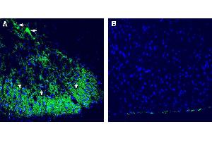 Expression of CALHM2 in rat spinal cord. (CALHM2 Antikörper  (Extracellular))