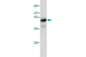 Western blot analysis of H520 whole cell lystae with IST1 monoclonal antibody, clone 22  at 1:1000 dilution. (IST1 Antikörper)