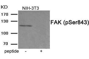Western blot analysis of extracts from 3T3 cells treated with PMA using Phospho-FAK (Ser843) antibody. (FAK Antikörper  (pSer843))