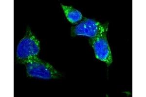 IF analysis of SLC2A1 using anti-SLC2A1 antibody (ABIN3043927).