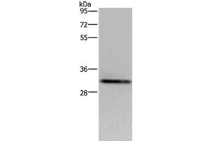 Western Blot analysis of OP9 cell using CD242 Polyclonal Antibody at dilution of 1:500 (ICAM4 Antikörper)