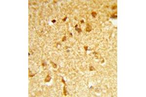 Formalin-fixed and paraffin-embedded human brain tissue reacted with DDX17 Antibody (N-term) followed which was peroxidase-conjugated to the secondary antibody, followed by DAB staining. (DDX17 Antikörper  (N-Term))