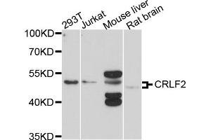 Western blot analysis of extracts of various cell lines, using CRLF2 antibody (ABIN4903379) at 1:1000 dilution. (CRLF2 Antikörper)