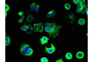Immunofluorescent analysis of MCF-7 cells using ABIN7171548 at dilution of 1:100 and Alexa Fluor 488-congugated AffiniPure Goat Anti-Rabbit IgG(H+L) (TAS2R41 Antikörper  (AA 205-234))
