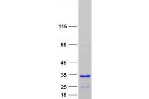 Western Blotting (WB) image for Coiled-Coil Domain Containing 103 (CCDC103) protein (Myc-DYKDDDDK Tag) (ABIN2713277)