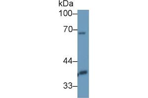 Detection of DLAT in Mouse Mastadenoma lysate using Polyclonal Antibody to Dihydrolipoyl Transacetylase (DLAT) (DLAT Antikörper  (AA 368-626))