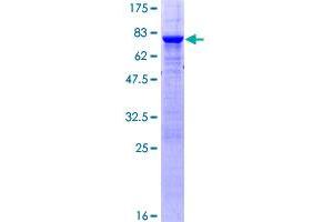 Image no. 1 for Protein tyrosine Phosphatase, Non-Receptor Type 2 (PTPN2) (AA 1-387) protein (GST tag) (ABIN1316834) (PTPN2 Protein (AA 1-387) (GST tag))