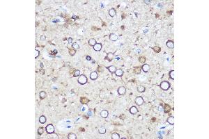 Immunohistochemistry of paraffin-embedded Rat brain using EY Rabbit pAb (ABIN6135167, ABIN6140386, ABIN6225031 and ABIN6225033) at dilution of 1:100 (40x lens). (EYA1 Antikörper  (AA 100-250))