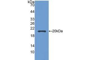 Detection of Recombinant SEMA5B, Mouse using Polyclonal Antibody to Semaphorin 5B (SEMA5B) (SEMA5B Antikörper  (AA 836-1013))