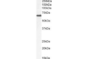 Western Blotting (WB) image for anti-Protein Phosphatase 2, Regulatory Subunit B', delta (PPP2R5D) (C-Term) antibody (ABIN184648)