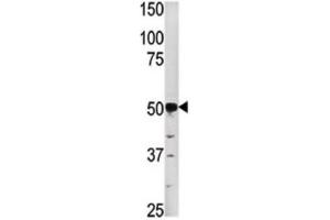 Western Blotting (WB) image for anti-Phosphoglycerate Kinase 2 (PGK2) antibody (ABIN3003022) (PGK2 Antikörper)
