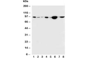 Western Blotting (WB) image for anti-Catenin, beta (CATNB) (N-Term) antibody (ABIN3030327)