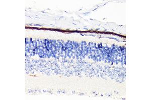 Immunohistochemistry of paraffin-embedded mouse retina using RPE65 Rabbit mAb (ABIN7269933) at dilution of 1:100 (40x lens). (RPE65 Antikörper)