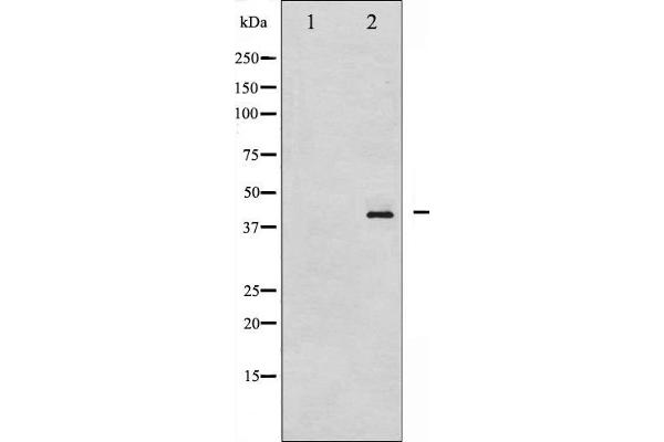 HDAC8 antibody  (pSer39)