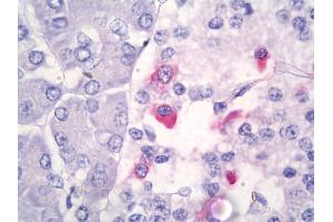 Anti-Somatostatin antibody IHC of human pancreas. (Somatostatin Antikörper)