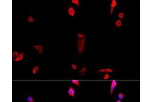 Immunofluorescence (IF) image for anti-Eukaryotic Translation Initiation Factor 3 Subunit J (EIF3S1) antibody (ABIN7264670)