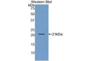 Western Blotting (WB) image for anti-Actin Related Protein 2/3 Complex, Subunit 4, 20kDa (ARPC4) (AA 3-165) antibody (ABIN3202611) (ARPC4 Antikörper  (AA 3-165))