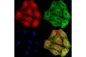 ABIN6261919 and ABIN6278467 staining Hela cells by IF/ICC. (GCLC Antikörper  (N-Term))