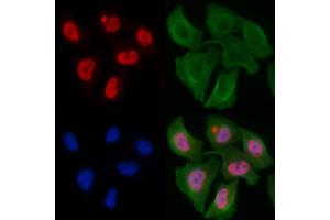 ABIN6256428 and ABIN6267317 staining Hela cells by IF/ICC. (Retinoblastoma Protein (Rb) Antikörper  (pSer807))