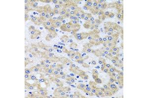 Immunohistochemistry of paraffin-embedded human liver injury using PEX3 antibody at dilution of 1:100 (x40 lens).