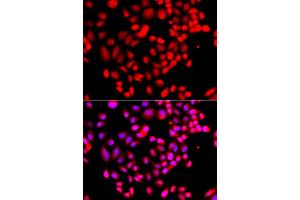Immunofluorescence analysis of A549 cells using RPS6KL1 antibody (ABIN5975299). (RPS6KL1 Antikörper)