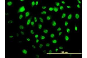 Image no. 2 for anti-Helicase with Zinc Finger (HELZ) (AA 1-101) antibody (ABIN599500) (HELZ Antikörper  (AA 1-101))