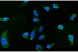 IF analysis of MSN using anti-MSN antibody (ABIN7600378).