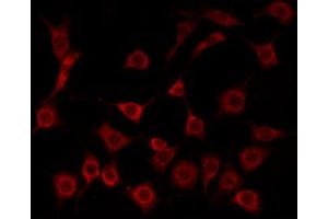 ABIN6275211 staining Hela by IF/ICC. (LDLRAD1 Antikörper  (Internal Region))