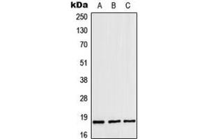 Western blot analysis of ZNHIT1 expression in MOLT4 (A), mouse heart (B), rat heart (C) whole cell lysates. (ZNHIT1 Antikörper  (Center))