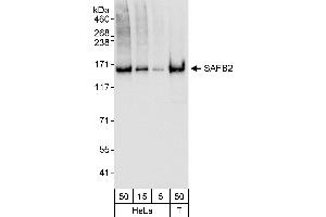 anti-Scaffold Attachment Factor B2 (SAFB2) (AA 75-125) antibody