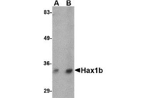 Western Blotting (WB) image for anti-Hax1b (N-Term) antibody (ABIN1031401) (Hax1b (N-Term) Antikörper)