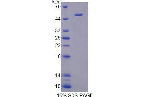 Image no. 1 for Keratin 25 (KRT25) (AA 1-446) protein (His tag) (ABIN6238464)